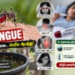 file 0000000033a482119c969af70348c83d டெங்கு காய்ச்சல் அறிகுறிகள்: கண்களுக்குப் பின்னால் வலி, உடல்வலி இருந்தால் அலட்சியம் வேண்டாம்!